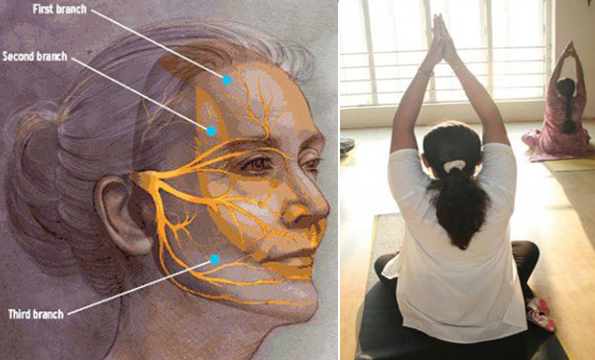 ATYPICAL FACIAL PAIN
