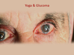 Glaucoma