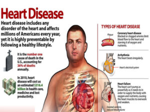 HYPERTENSION AND HEART DISE