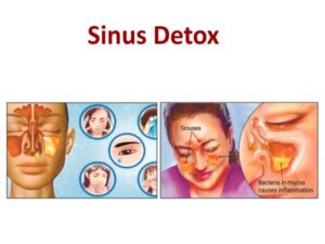 Sinus Detox