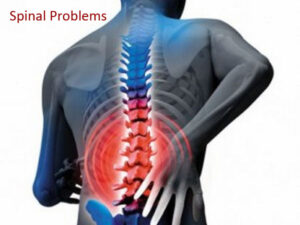 Spinal problems